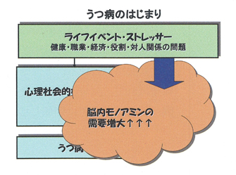 うつ病のはじまり