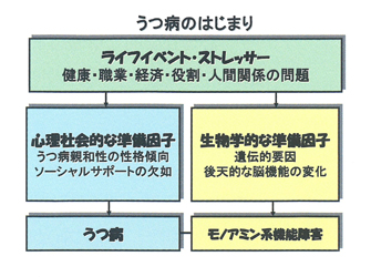 うつ病のはじまり