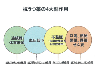 抗うつ薬の4大副作用