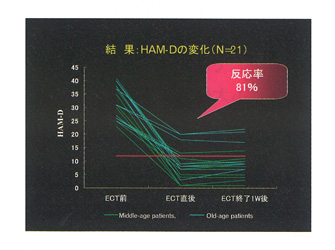 HAM-Dの変化
